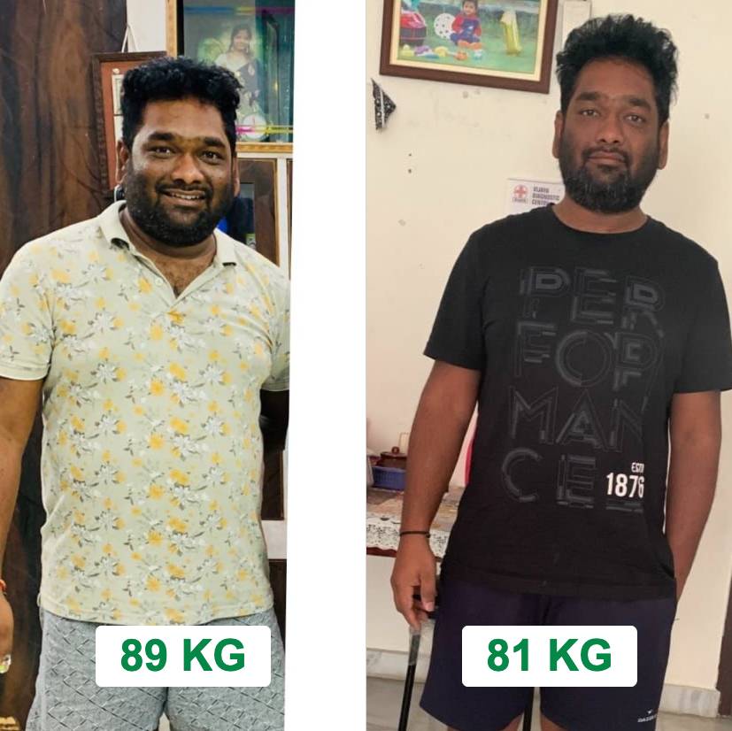 Weight liss journey