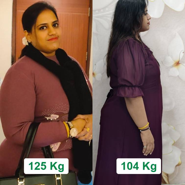 Weight loss -20 kg in 3 months