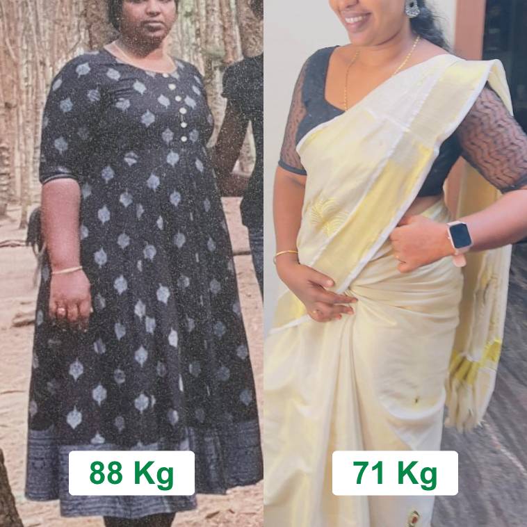 Weight loss 