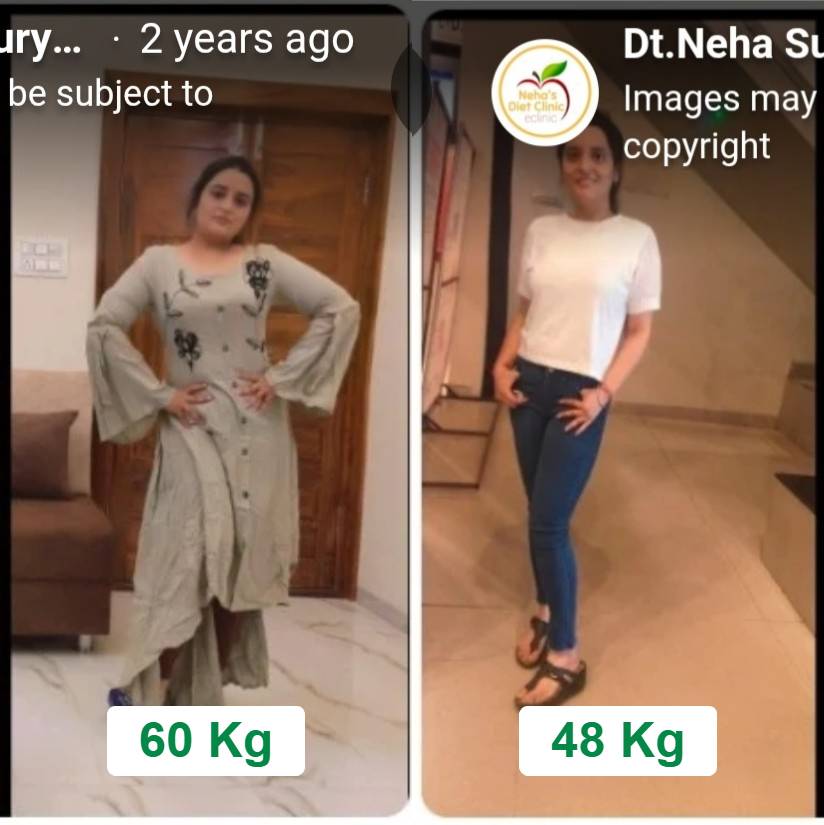 Transformation Journey Of Priya 