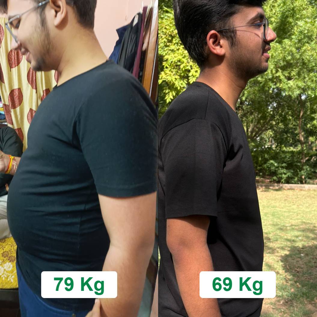 Lakshay’s Weight Loss Journey