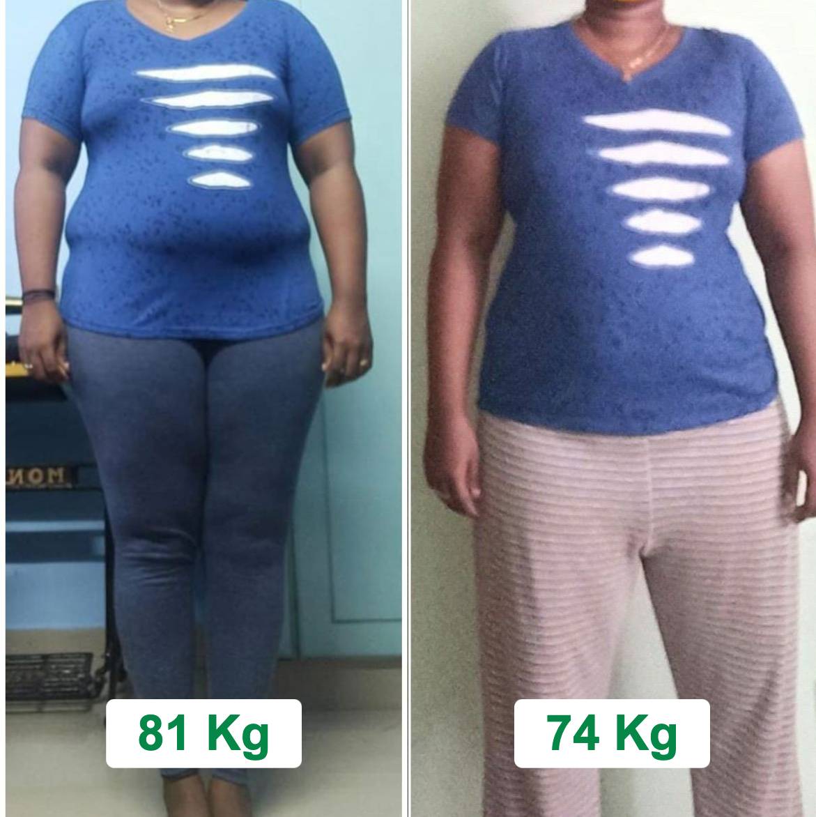 Weight loss Transformation 